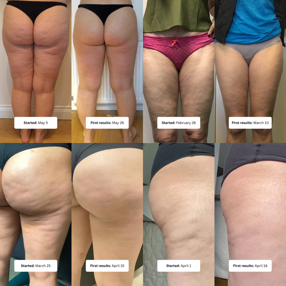 Cellulite Massage Oil